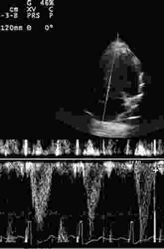 Echocardiography For Intensivists Yancy Caruthers