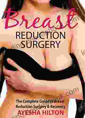 Breast Reduction Surgery: The Complete Guide To Breast Reduction Surgery Recovery